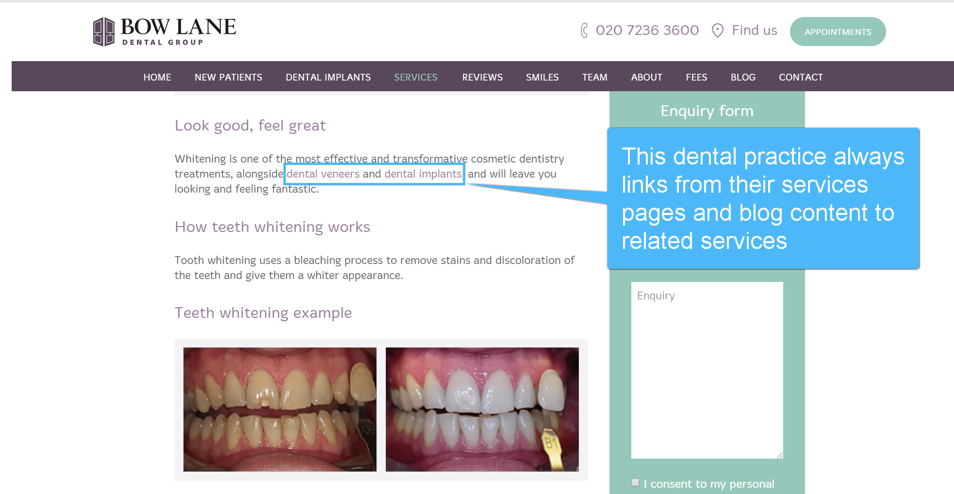 Example of internal linking on a dental clinic's website
